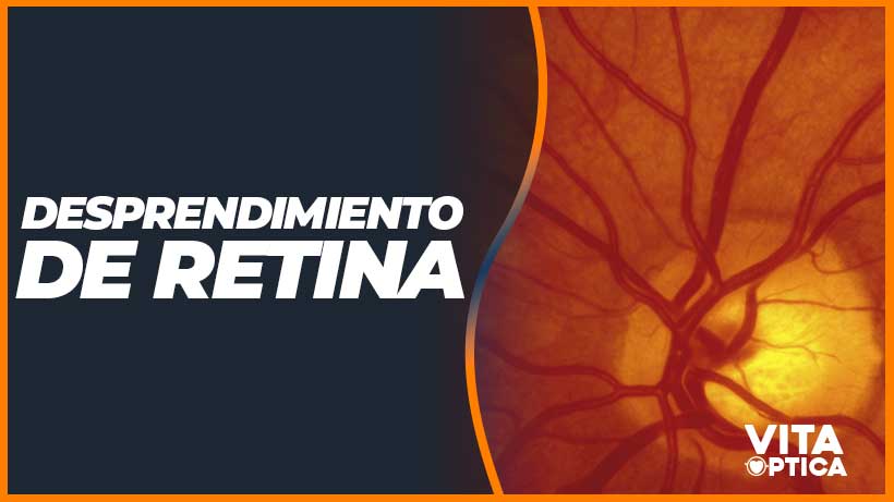 desprendimiento de retina problema en los ojos que te puede dejar ciego