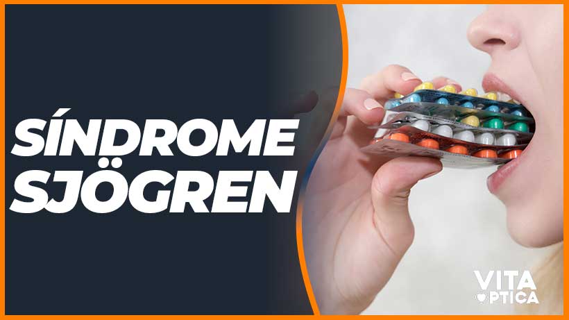 el sindrome sjogren es una patologia que se caracteriza por generar un tipo de ojo seco como solucionarlo