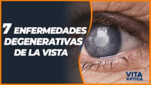 enfermedades degenerativas de la vista ojos tratamientos consejos soluciones
