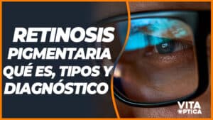 retinosis pigmentaria retinitis pigmentosa ceguera nocturna que es sintomas diagnostico